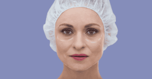 Best Treatment for Under Eye Wrinkles in Grandville